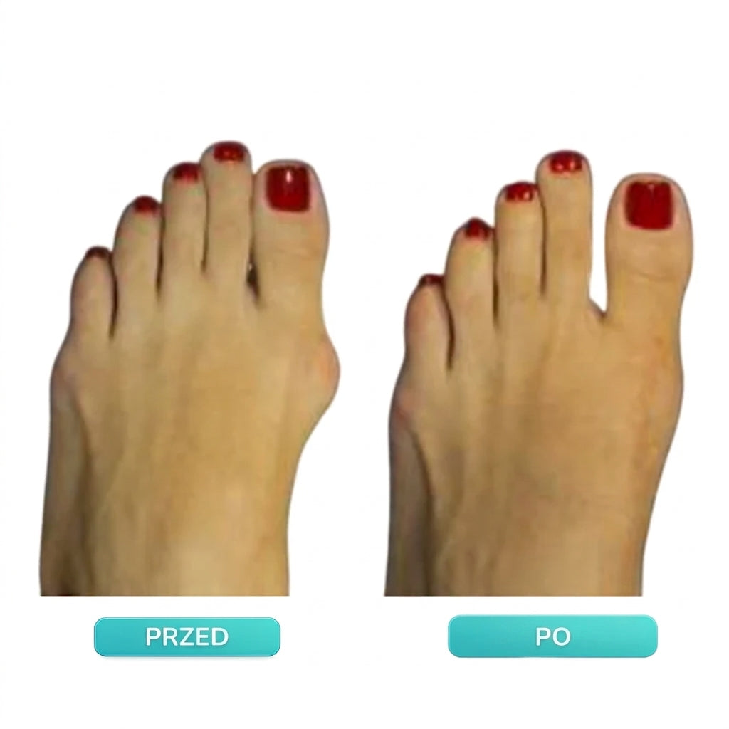 Pisada™ - Pozycjoner na haluksy